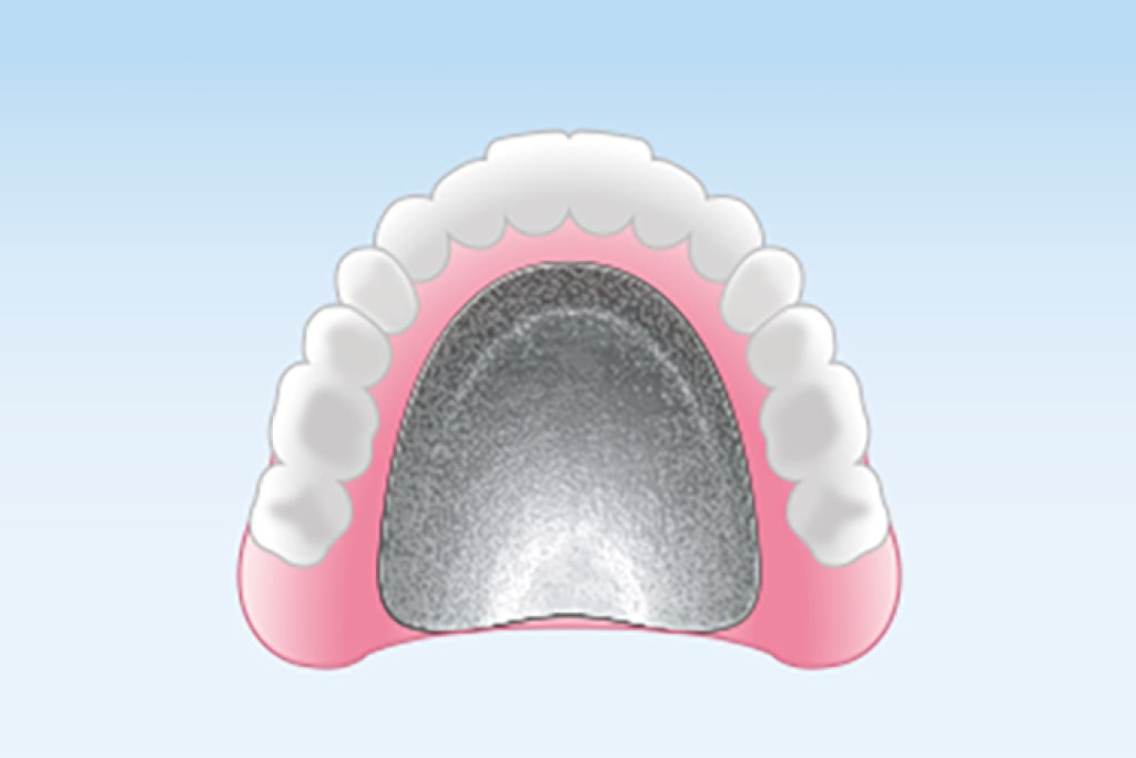 金属床義歯(自由診療)